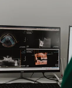 innovazione digitale dentista ascoli piceno