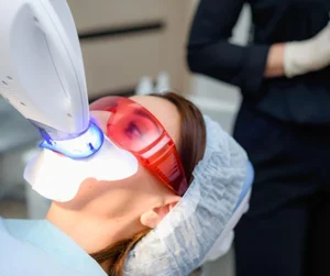 Sbiancamento denti Ascoli Piceno