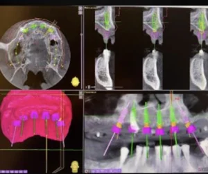 Chirurgia computer guidata Ascoli Piceno