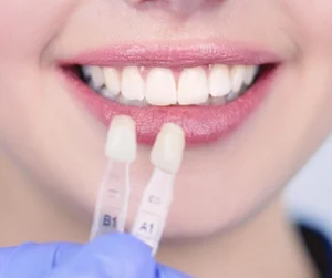 estetica dentale Ascoli Piceno