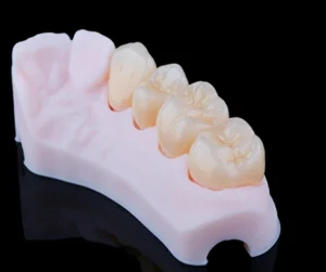 Protesi dei denti Ascoli Piceno