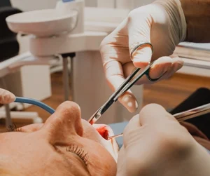 Sinus lift ascoli piceno