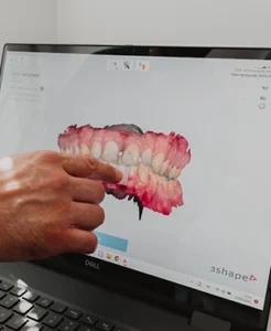 impronta dentale Ascoli Piceno
