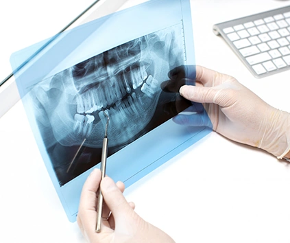 Ricrescita osso denti Ascoli Piceno