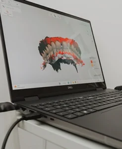 Scanner intraorale Studio dentistico Ascoli Piceno - Dott. Andrea De Benedictis