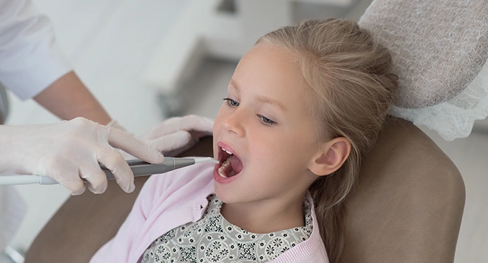 Sigillatura dei denti nei bambini: cos’è, a cosa serve e quando è consigliata