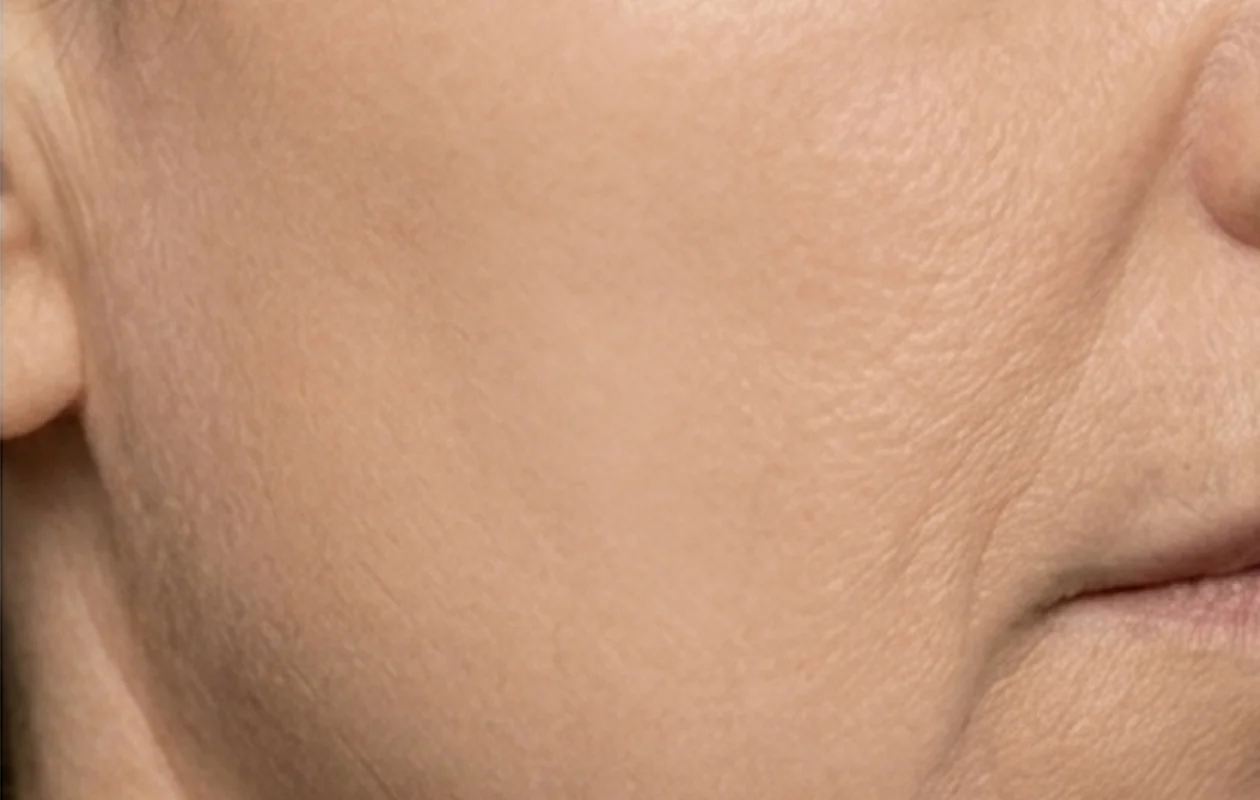 dopo macchie cutanee