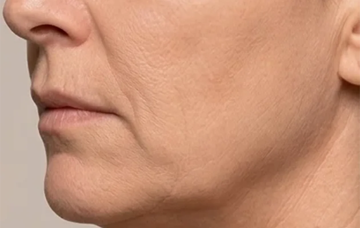 prima ringiovanimento viso