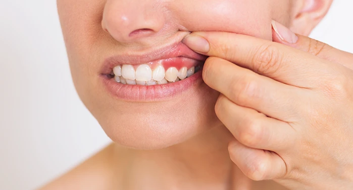 Ho un ascesso o dolore ai denti: devo venire subito? 3 segnali per capire se è un’emergenza